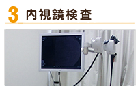 内視鏡検査